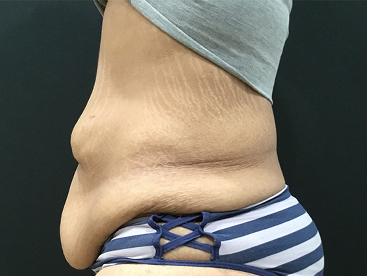 Case--3609 | Before Fleur de Lis 2