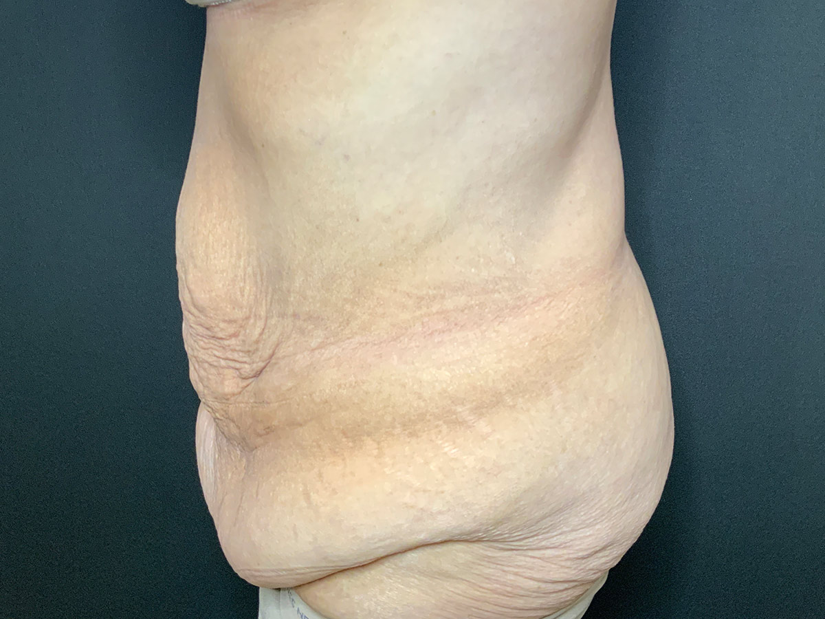 Case--2683 | Before Fleur de Lis 2